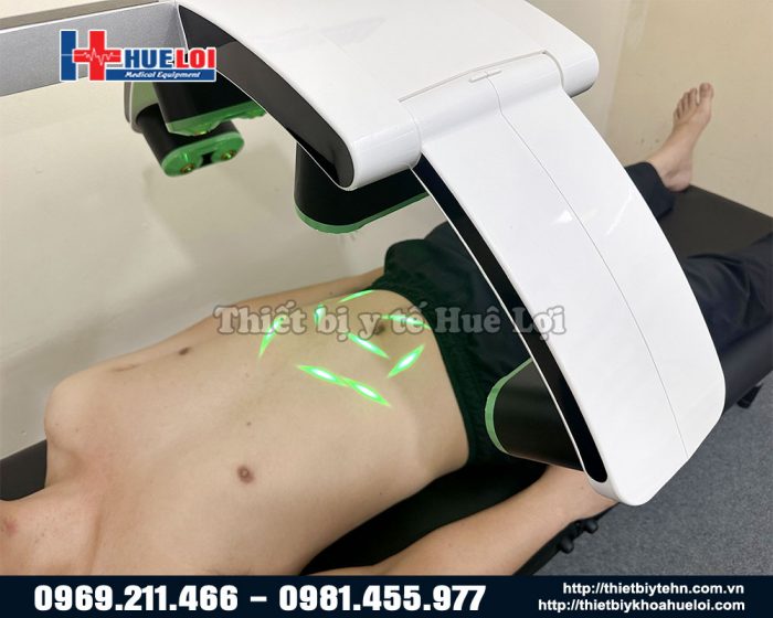 Đốt mỡ bụng bằng máy Laser Lux Master Slim