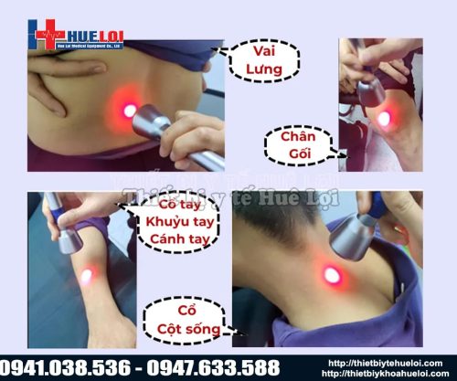 Ứng dụng thực tế của EC30 đa bước sóng trong trị liệu đau cơ - xương - khớp