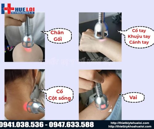 Vị trí ứng dụng máy laser EC30 đơn bước sóng trong điều trị đau cơ – xương – khớp