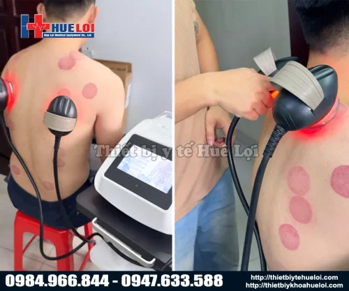 Đả thông kinh lạc bằng máy dds 3in1